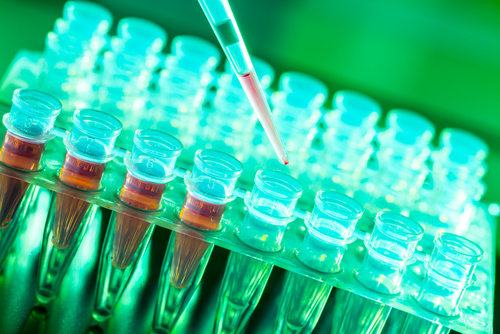 4D Molecular Therapeutics Raises $90M; Clinical Testing for Gene Therapies