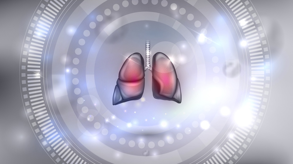 Translate Bio tries to raise $90 million for its cystic fibrosis treatment