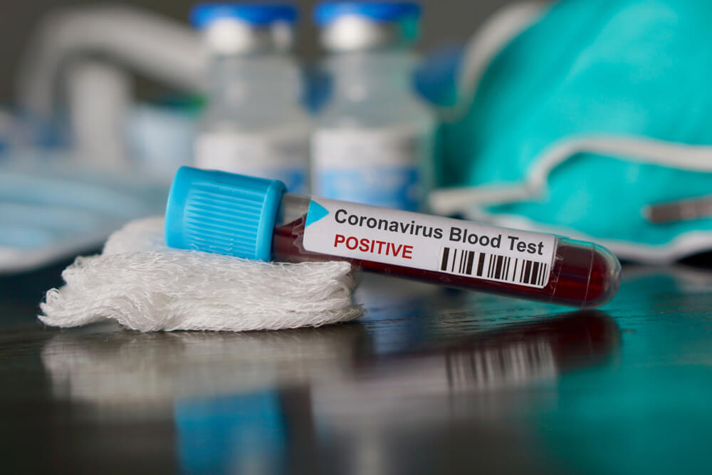 America’s early response to Coronavirus was a complete disaster. Learn from a former CDC Officer Why