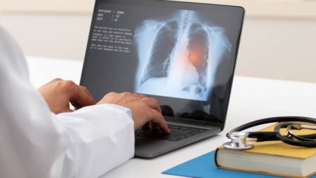 Optellum, AI Lung Cancer Diagnosis Innovator, Raises $14M in Series A to Further Expand