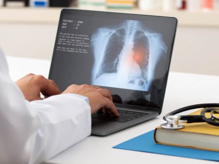 Optellum, AI Lung Cancer Diagnosis Innovator, Raises $14M in Series A to Further Expand