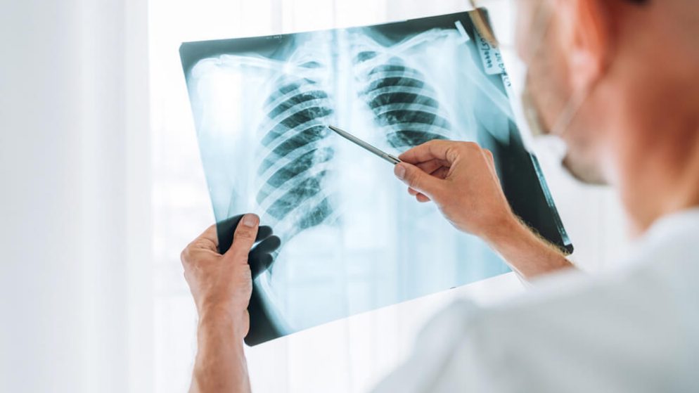 The Warning Signs of Lung Disease You Need to Know