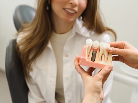 Dental Implants 101: Types, Costs, Maintenance, And More