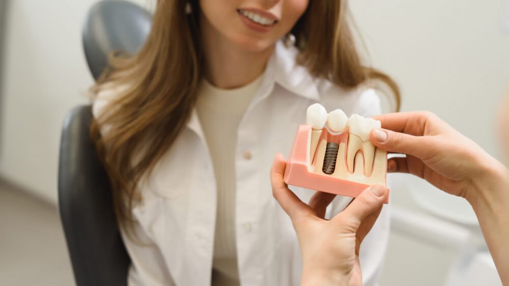 Dental Implants 101: Types, Costs, Maintenance, And More